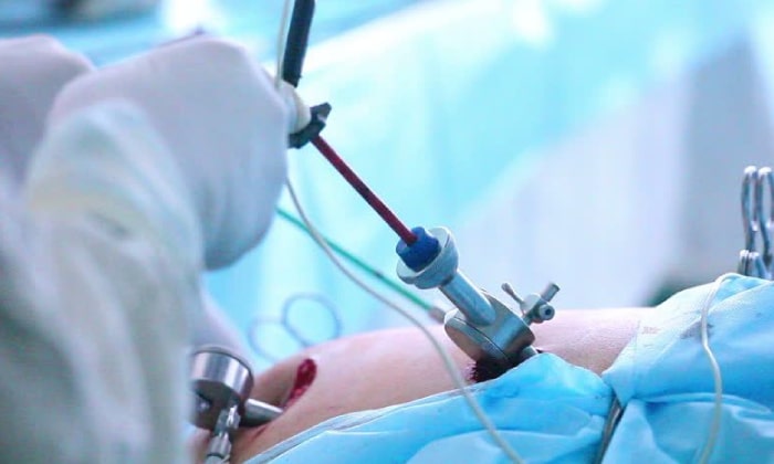 pediatric laproscopy surgery in pune